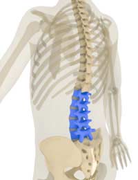 Chordoma Back Pain Cancer Spine Spinal
