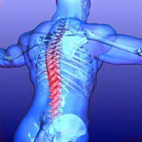 Causes of Back Pain