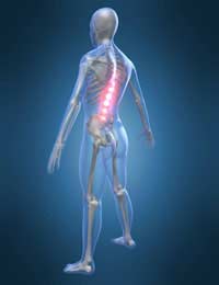 Ankylosing Spondylitis; Arthritis; Pain;